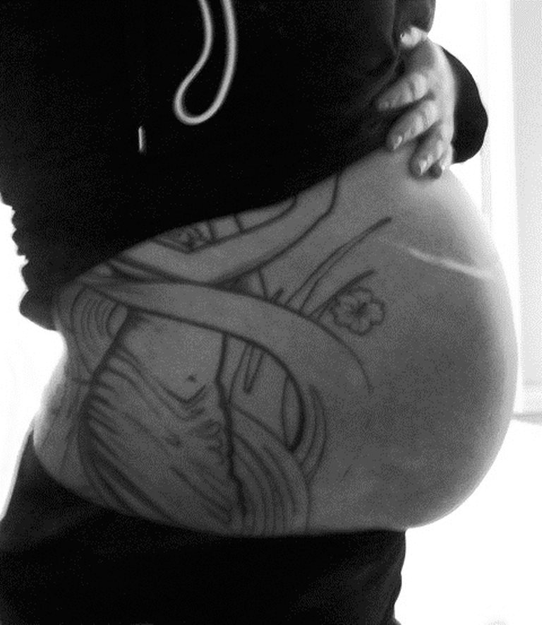 My Weight Loss Journey - 100 Pounds & Counting